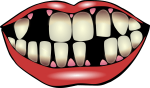 Cómo prevenir la pérdida de dientes