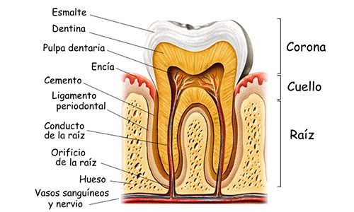 Infección en el diente