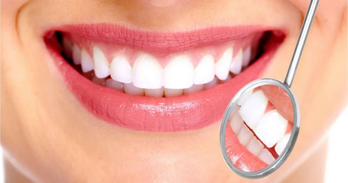 Los famosos usan carillas dentales - Seguros Dentales – Pólizas Familiares